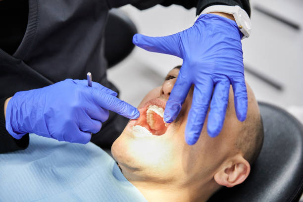 Best Cracked Tooth Emergency Dentist  in Chapman, KS