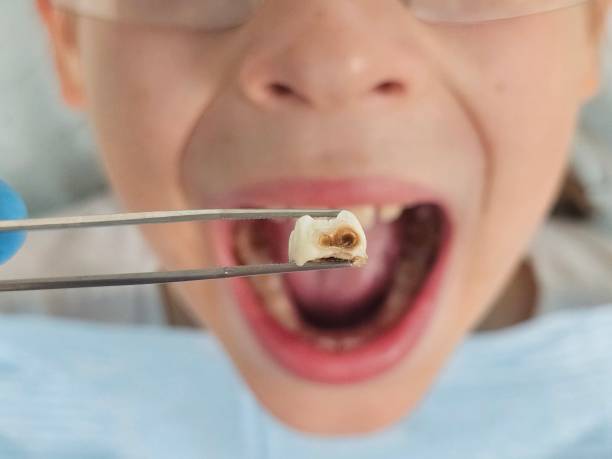  Chapman, KS Emergency Dentist Pros